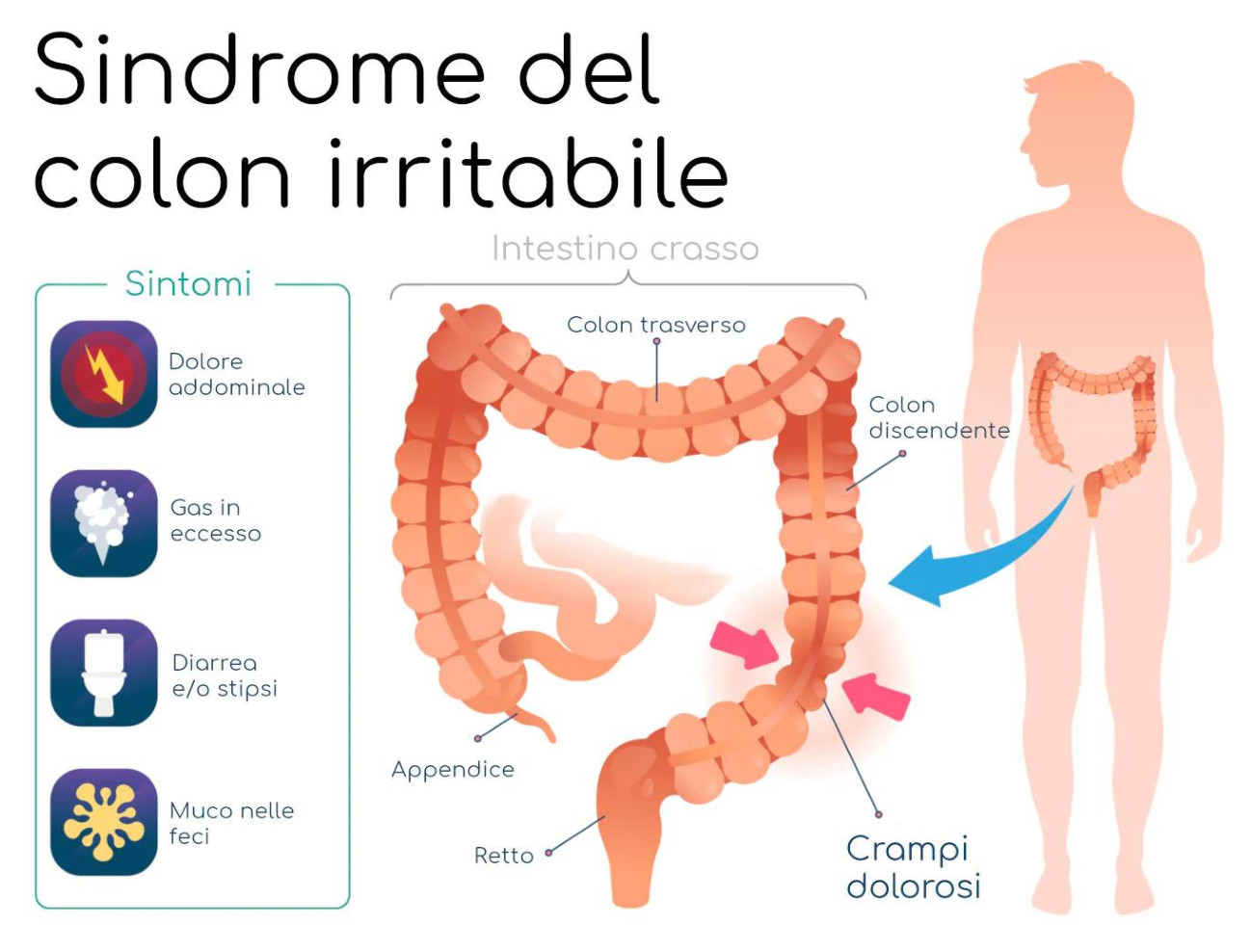 foto-sindrome-colon-irritabile